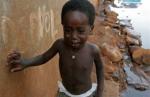 Deca umiru od gladi i pothranjenosti