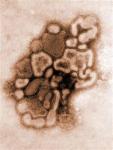 Novi grip praćen bakterijskom infekcijom