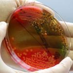 Više od 20 dece zaraženo salmonelom u Valjevu