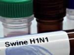 Nema registrovanih novih slučajeva: U BiH jenjava zaraza virusom H1N1?