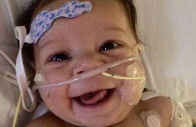 (FOTO) Ova beba umrla je na operacionom stolu ali 7 dana kasnije...