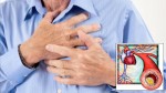 Indikatori infarkta: Odnos HDL sa holesterolom i trigliceridima