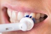 Klasična ili električna četkica: Koja je bolja za vaše zube?