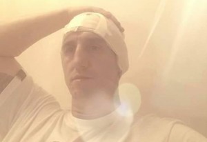 Kristijan se oglasio nakon operacije: Mogao sam da oslepim! (Foto+Video)