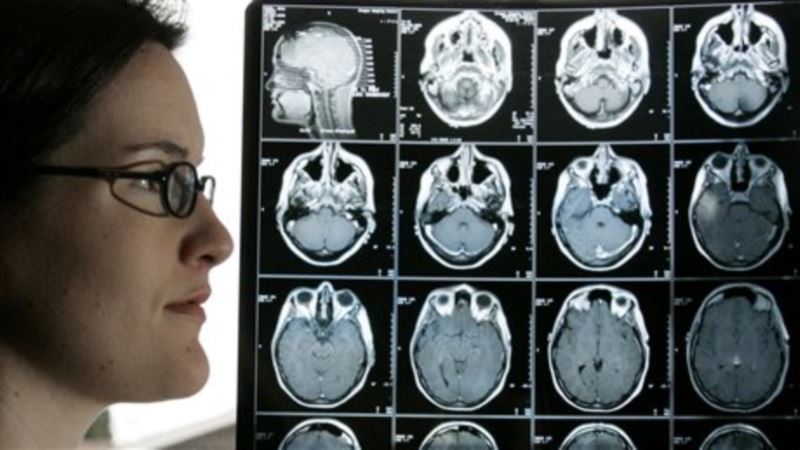 Napredak u lečenju tumora na mozgu?