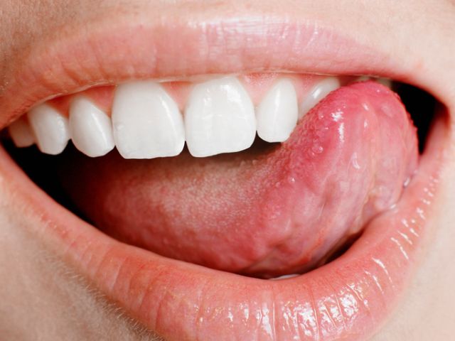 Otisci zuba na jeziku otkrivaju mnoge ozbiljne bolesti!