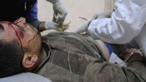 STRAŠNO U bombaškim napadima u Siriji juče poginulo 150 LJUDI