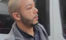 SVE ZA LEPOTU: Džihadista uhapšen tokom transplantacije kose