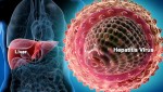 Šta je Hepatitis A, B, C i koje vrste hepatitisa imamo