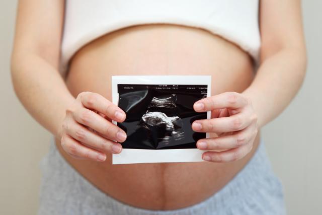 Umesto bebe, ultrazvučni snimak pokazao da par očekuje auto