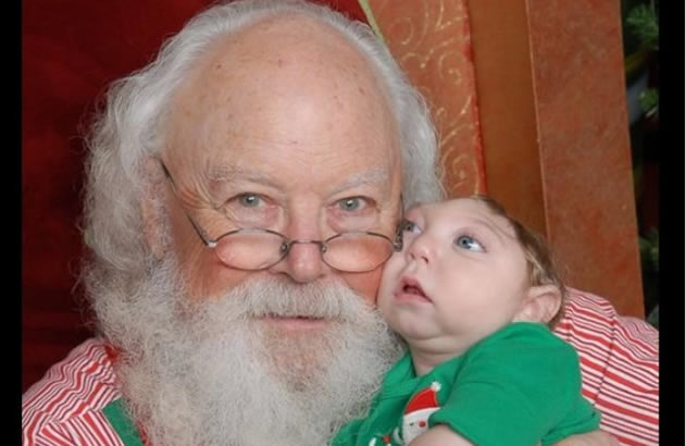 (VIDEO I FOTO) MALI HEROJ Decak rodjen bez pola lobanje je prvi put upoznao Deda Mraza