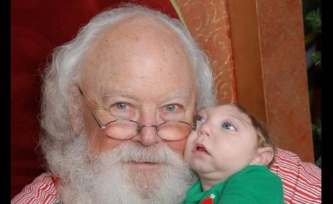 (VIDEO I FOTO) MALI HEROJ: Dečak rođen bez pola lobanje je prvi put upoznao Deda Mraza