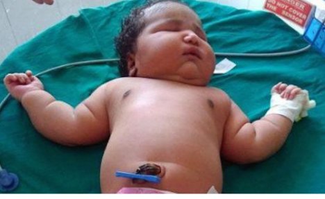 (VIDEO) NAJTEŽA BEBA ROĐENA U INDIJI: Devetnaestogodišnja devojka rodila bebu tešku 6,8 kilograma