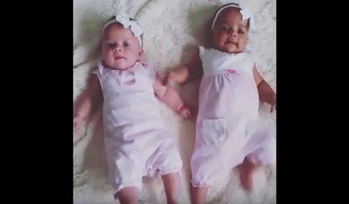 VIDEO: Rodili se crno-beli blizanci