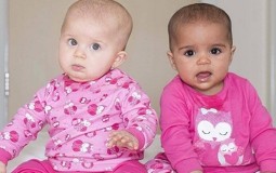 
					Velika Britanija: Rodili se crno-beli blizanci 
					
									