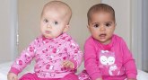 Velika Britanija: Rodili se crno-beli blizanci