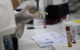 
					Više od 51.000 slučajeva zaraze virusom zika u Kolumbiji 
					
									
