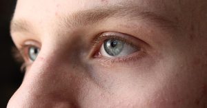 Скривени разлози зашто кожа око очију брже стари