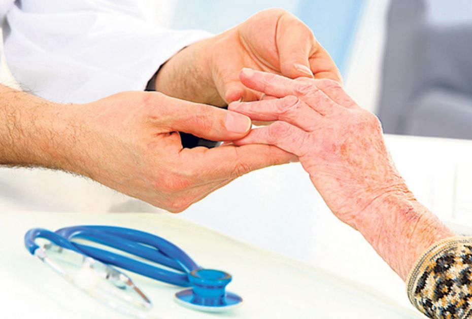 12 znakova reumatoidnog artritisa na koje odmah treba reagovati: Ako ste ujutru ukočeni duže od pola sata - trk kod lekara