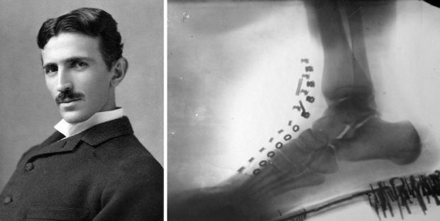 Никола Тесла направио је рендгенски снимак сопственог стопала машином коју је сам дизајнирао 1896
