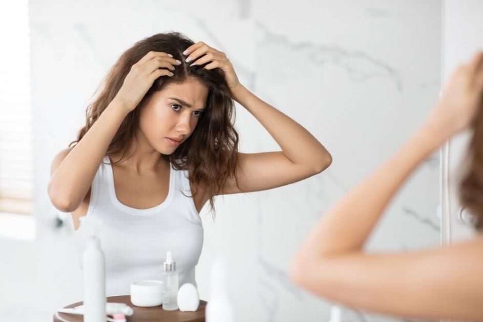 3 NAJČEŠĆA RAZLOGA SVRABA TEMENA: Obratite pažnju na crvenilo, perutanje i oštećenu kosu