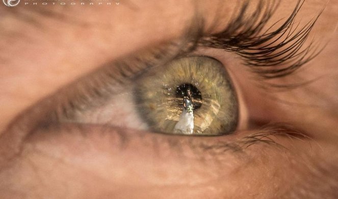 AMERIČKI NAUČNICI TVRDE: Oči mogu odati imate li koronavirus, EVO KAKO IZGLEDAJU!