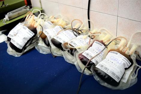 APEL Institut za transfuziju krvi pozvao građane da daju krv, rezerve opale