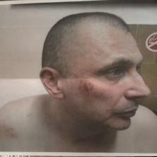 Advokat brutalno pretučen zbog psovke: Policijska tortura šokirala javnost – a napadači na dekana Drida i dalje na slobodi?