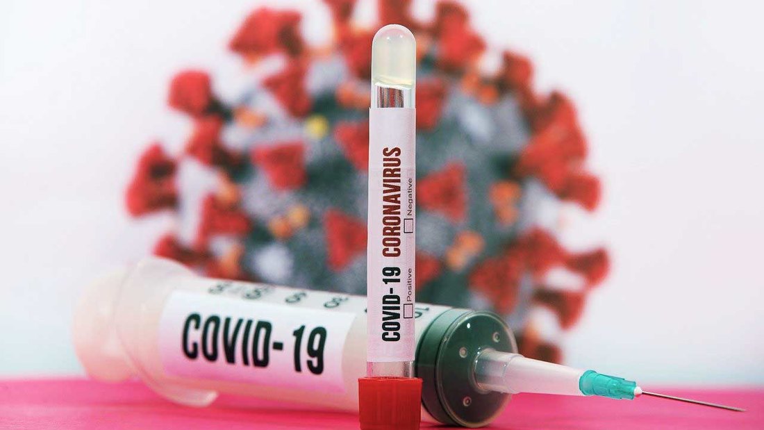 AKTUELNO: Preminulo 9 pacijenata, koronavirus potvrđen kod još 295 osoba