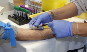 Alarmantna situacija: Smanjene rezerve krvi, nedostaju sve krvne grupe