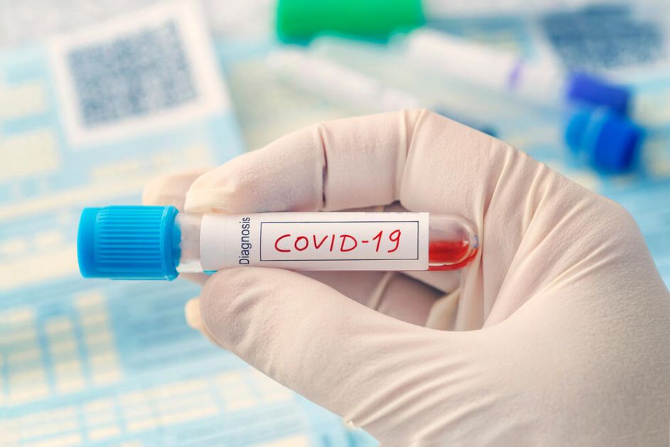 Australijski doktori: „Dugi kovid“ ne postoji, simptomi koronavirusa ništa drugačiji od gripa