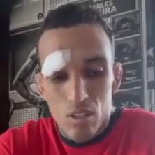 BAŠ GADNO IZGLEDA: Oliveira objavio snimak posekotine zbog koje propušta duel, Vajt ga OSUDIO (VIDEO)