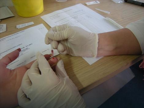 BATUT: Registrovano još 105 inficiranih HIV-om od početka godine