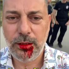 Babić napadnut u Pionirskom parku? Poznati biznismen sav krvav, pa poručio jednu stvar studentima koji hoće da uče (VIDEO)