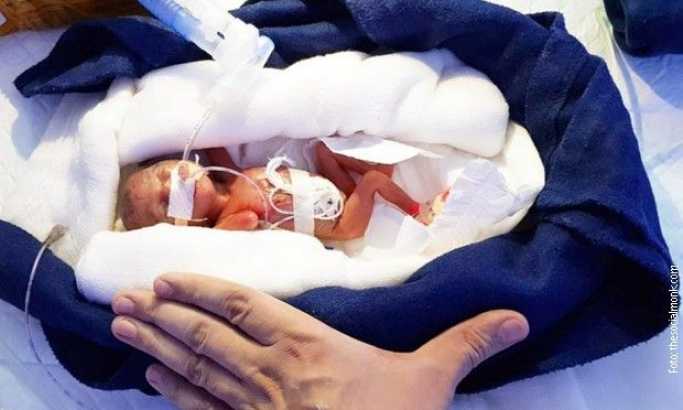 Beba koja se rodila sa 400 grama izborila se za život