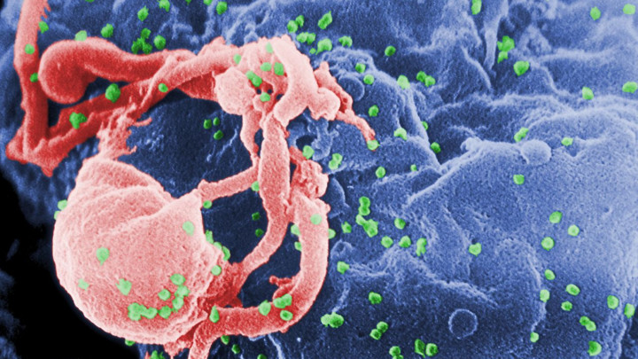 Belgijski naučnici otkrili gde se krije virus HIV-a