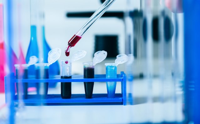 Brnabić o o testiranju na kovid-19 u privatnim laboratorijama: Odluka u narednim danima