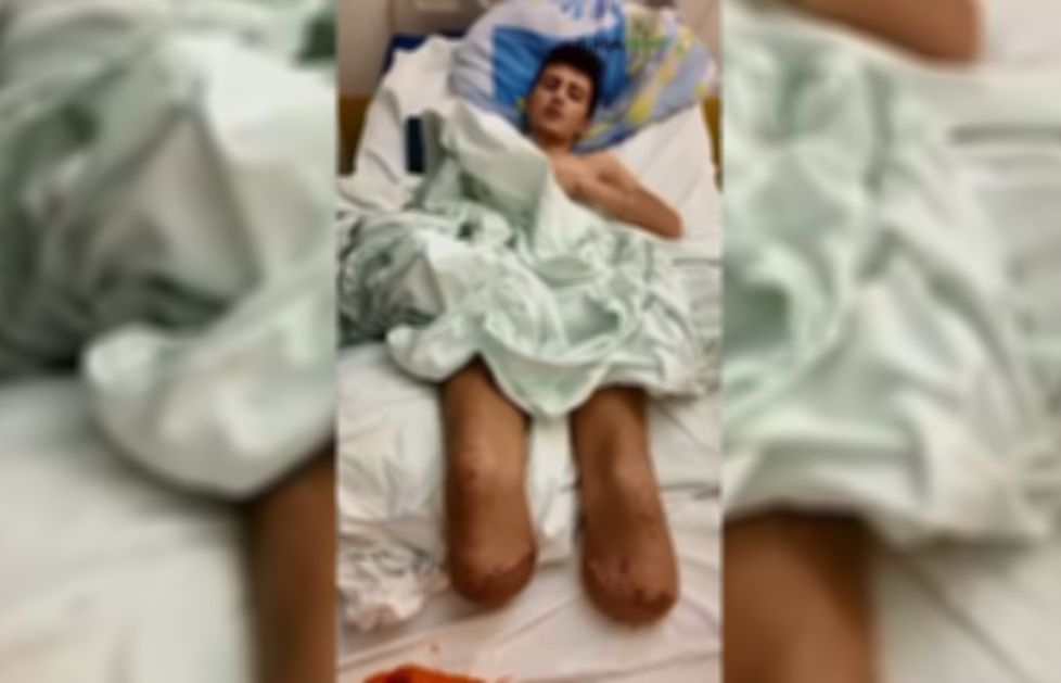 Brutalno nasilje: Migrantu Šahidu iz Maroka amputirane noge nakon prebijanja