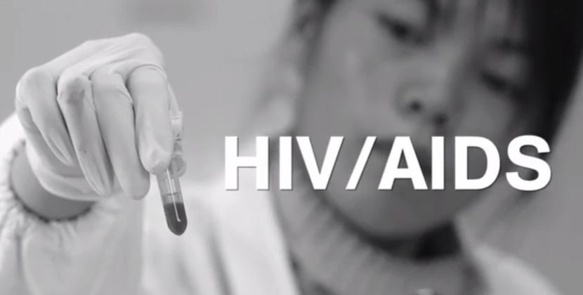 Čak 40 odsto zaražene populacije HIV virusom ne zna da je obolelo!