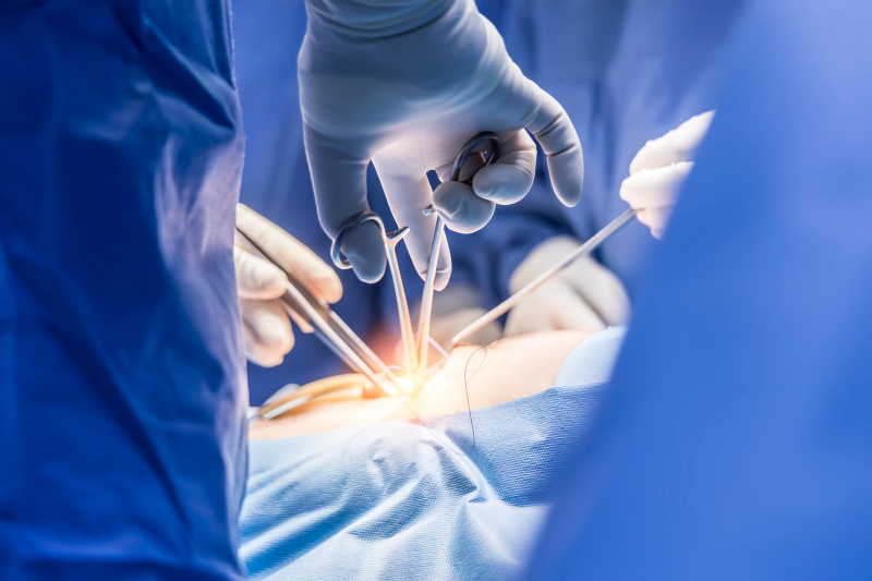 Čovek u Kini živeo više od 170 dana nakon transplantacije svinjske jetre