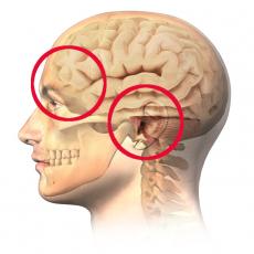 DA LI GLAVOBOLJA MOŽE BITI ZNAK TUMORA NA MOZGU? 7 simptoma zbog kojih morate ODMAH kod lekara