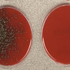 DA LI NAS MASKA ZAISTA ŠTITI?! Mikrobiolog uradio EKSPERIMENT - Saznanje će vas ŠOKIRATI! (FOTO)