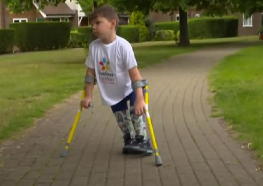 DEČAK SAKUPIO VIŠE OD MILION FUNTI ZA BOLNICU: Ostao bez nogu kao beba, a sada je pravi heroj! (VIDEO)