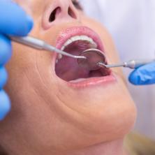 DONETA OZBILJNA ZABRANA: OVO odlazi u zaborav, a da li će se to svideti stomatolozima?