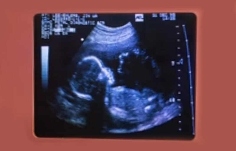 DZ Novi Sad: Edukacija trudnica o gestacijskom dijabetesu od danas u Almaškoj 4