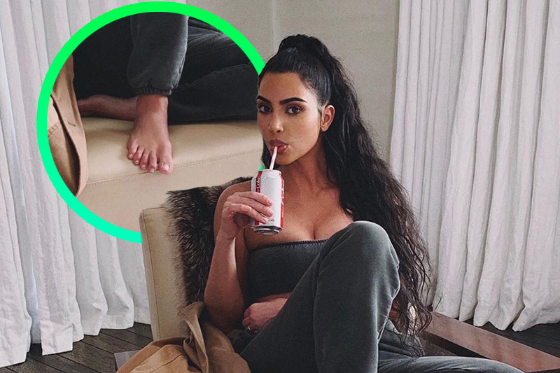 Da li Kim Kardashian ima 6 prstiju na stopalu? Evo šta ona kaže