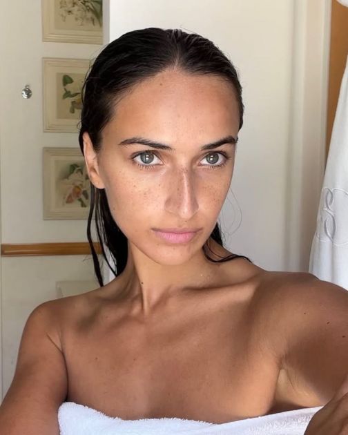 Da li je filerima odzvonilo? Regenerativna estetika je trend koji menja koncepciju beauty sveta
