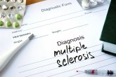 Da li je multipla skleroza neizlečiva bolest?