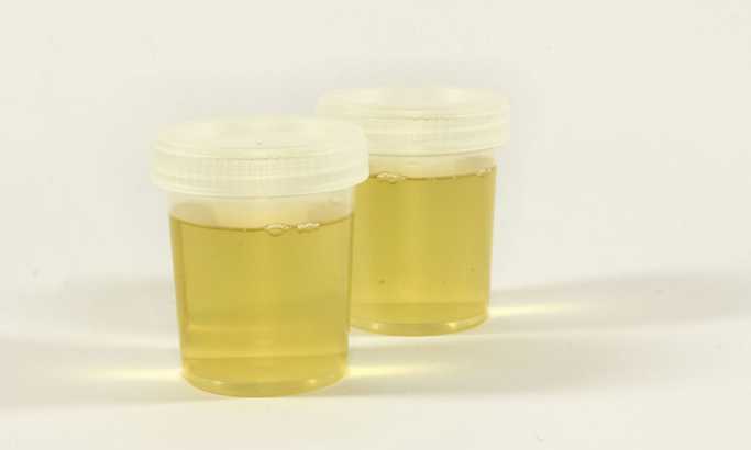 Da li urin zaista ima lekovito dejstvo?