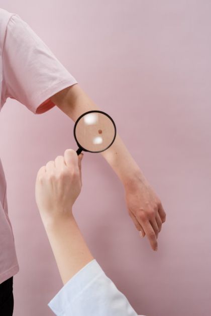 Danas preventivni pregledi za rano otkrivanje malignih tumora kože